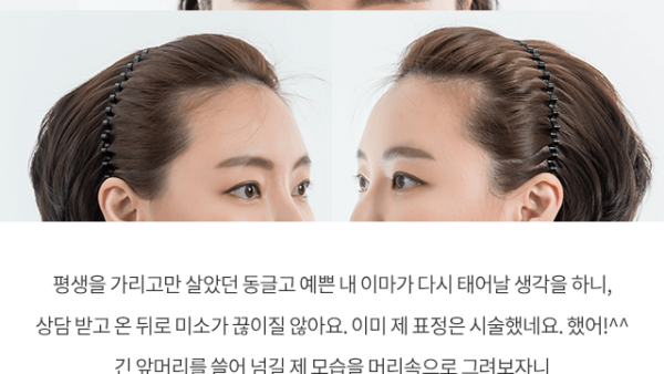 김민옥_비포_리얼12.png
